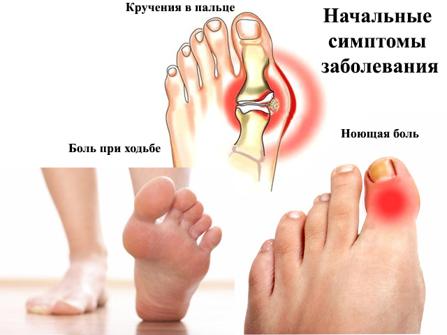 Травма ногтя – необходимые действия
