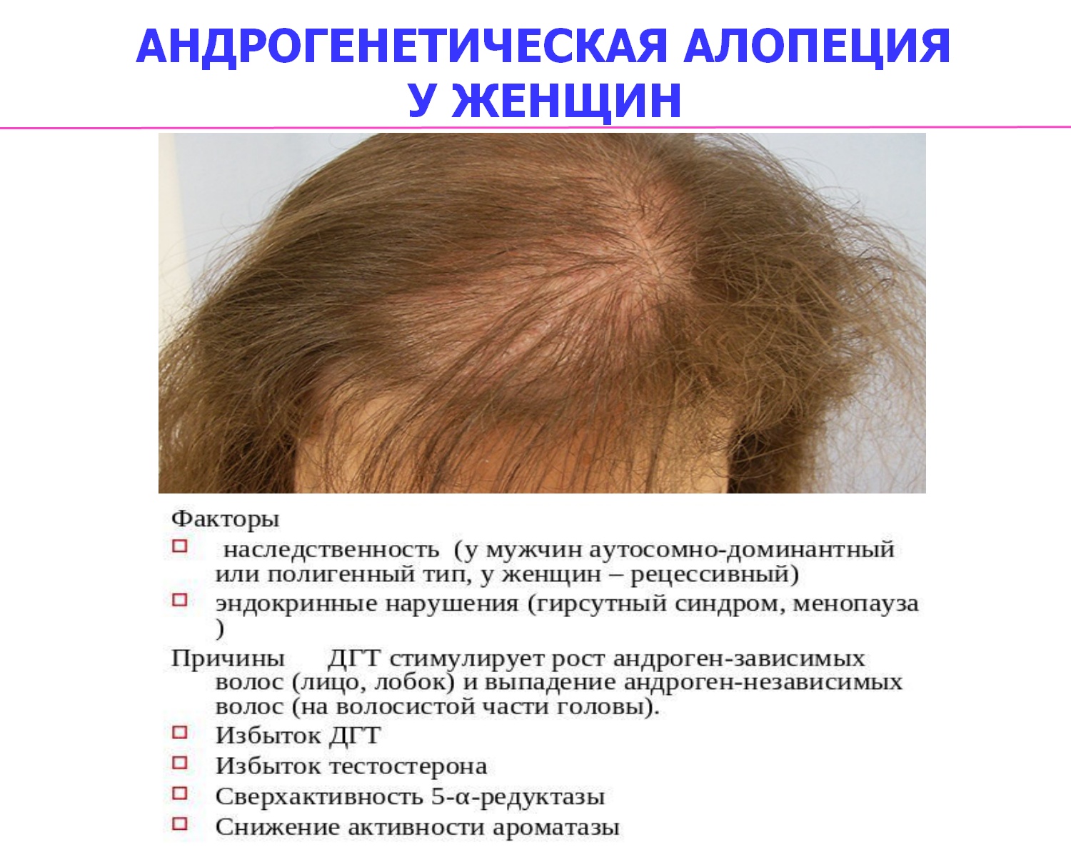 Андрогенное облысение и алопеция у женщин - как вылечить андрогенное выпадение волос у женщин