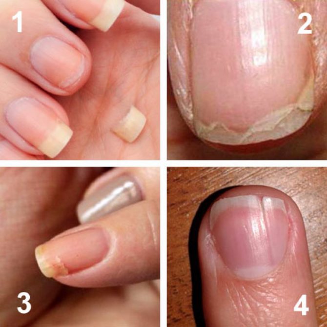 Как восстановить обгрызанные ногти маникюром: пошаговая инструкция
