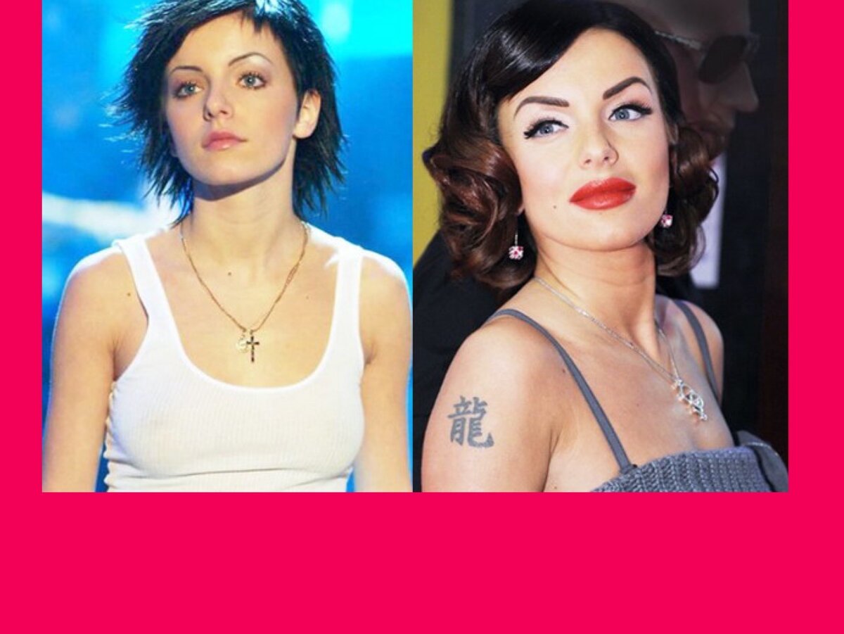 Юлия волкова после пластики: фото певицы после увеличения губ и груди, какие операции делала, как выглядит сейчас экс-солистка «тату»