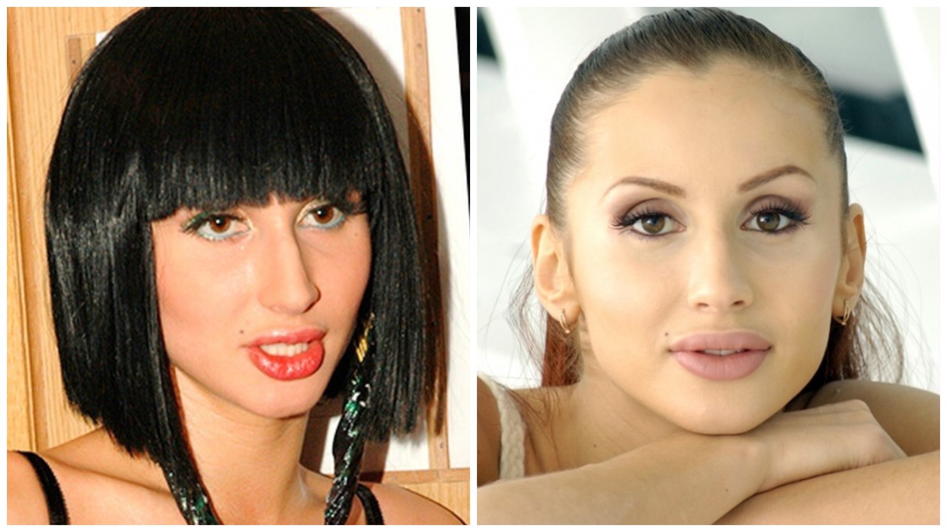 Необычная светлана лобода: до и после пластики, как меняла внешность певица