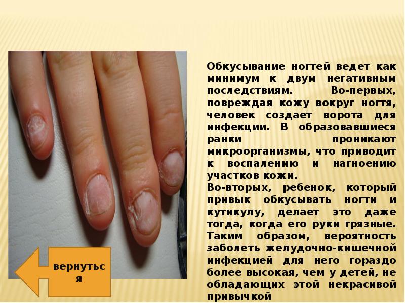 Основные заболевания ногтей