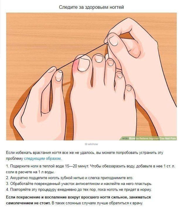 Как правильно стричь ногти на ногах: подготовка, пошаговая инструкция
