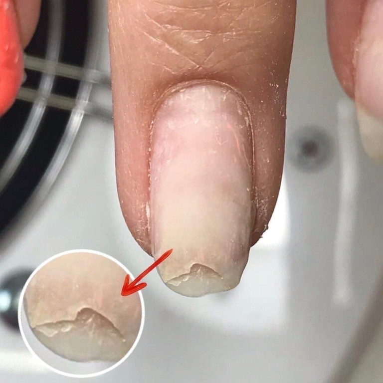 Почему отслаиваются наращенные гелем ногти у основания и от свободного края
