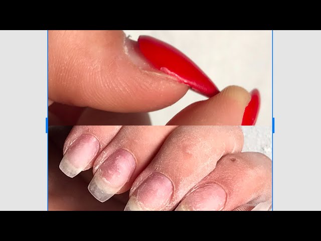 Как сделать коррекцию гелевых ногтей? — modnail.ru — красивый маникюр