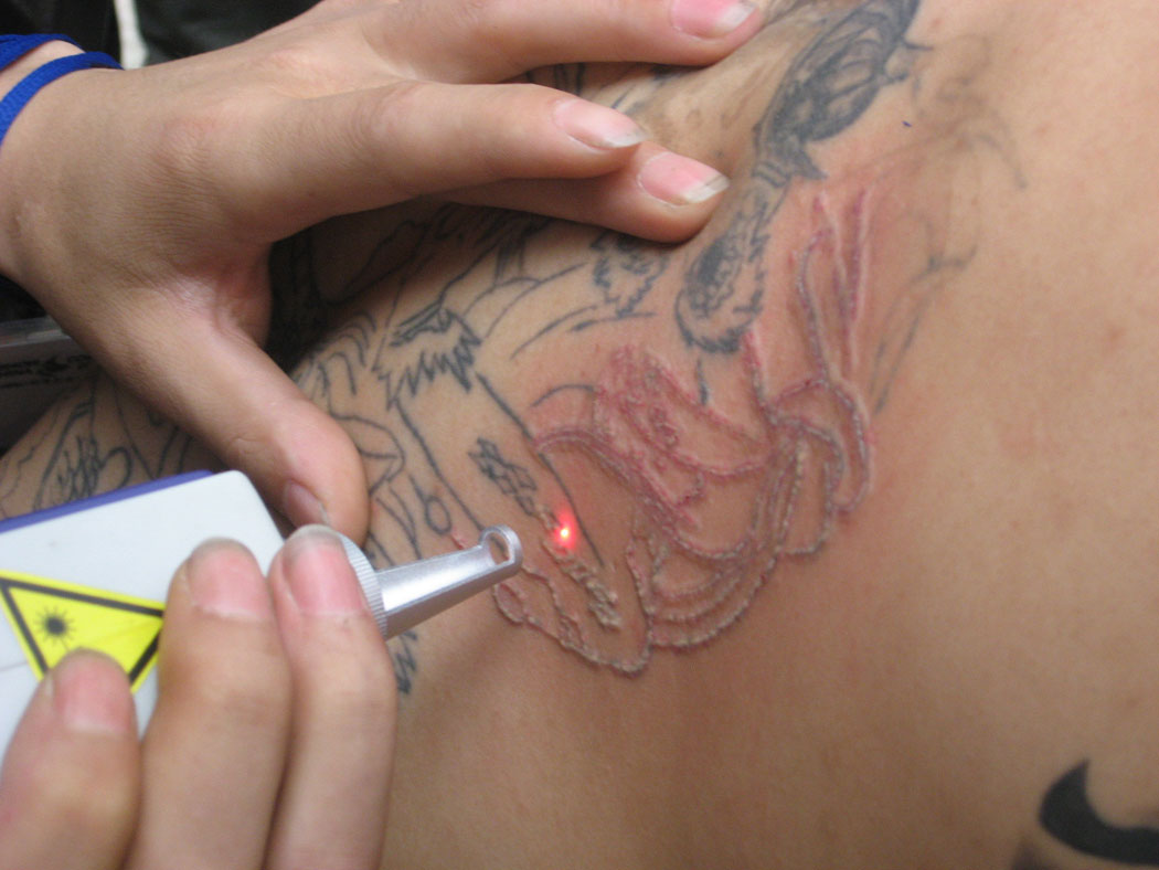 После нанесения что делает. Свежая Татуировка. Процесс нанесения Татуировки.