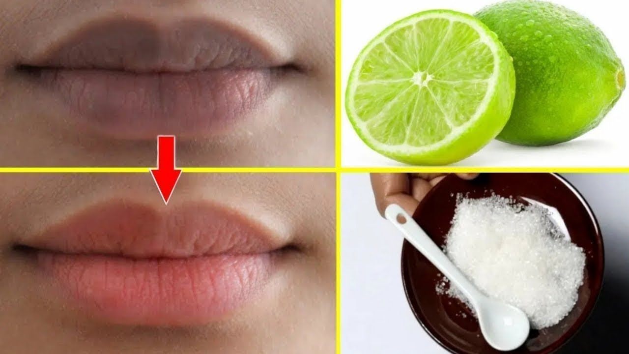 Увеличение больших половых губ