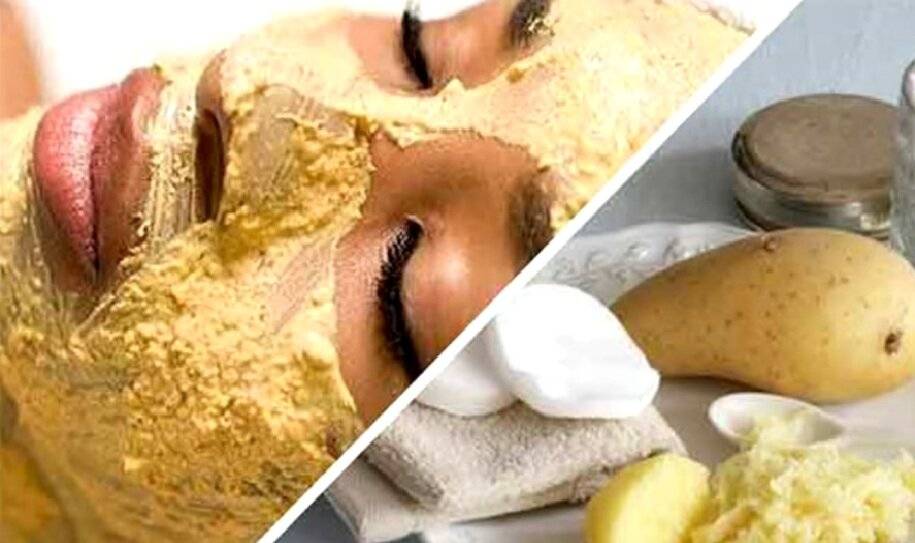 Мешки под глазами