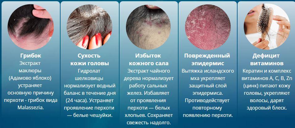 Себорея кожи головы: лечение, причины