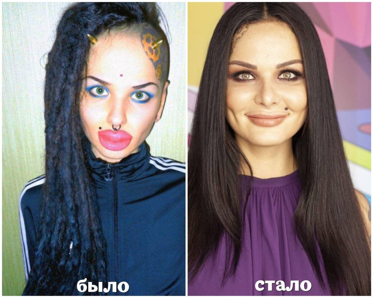 Кристина рэй до и после пластики, какие операции делала? фото до и после