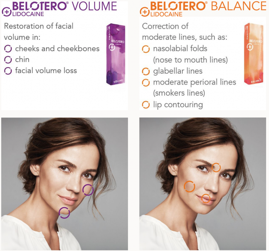 Belotero