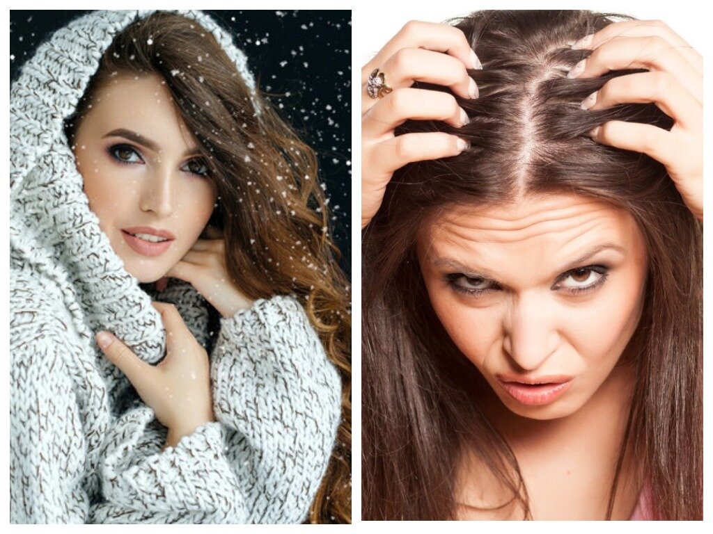 Уход за волосами зимой в условиях домашних, советы по уходу за волосами зимой, ход за кожей головы и волосами зимой