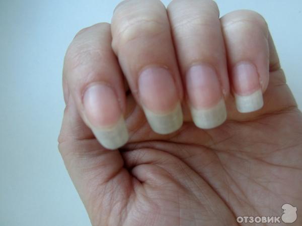 Почему ногти ребристые: почему появляется, как ее восстановить?