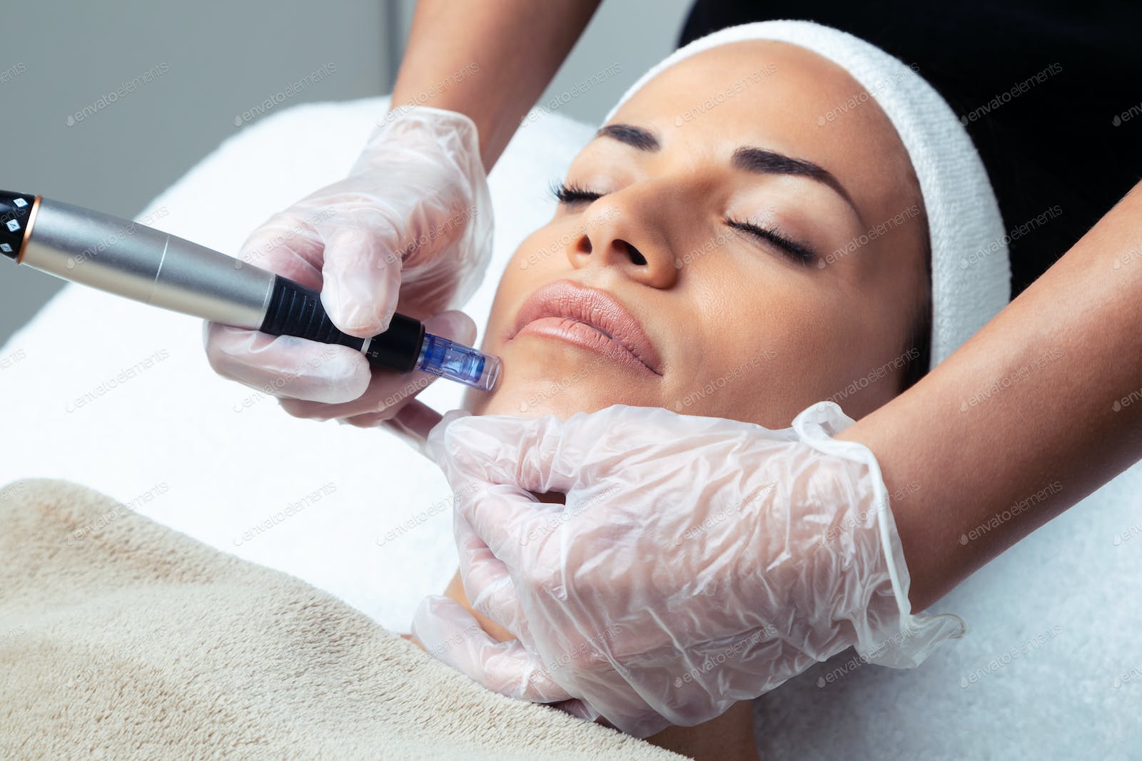 Фракционная мезотерапия кожи лица – эффективность тысячи уколов красоты!