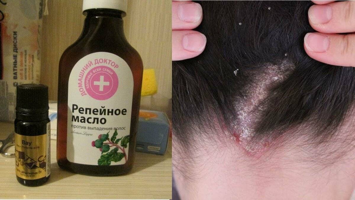 Секреты репейного масла для волос: польза и применение