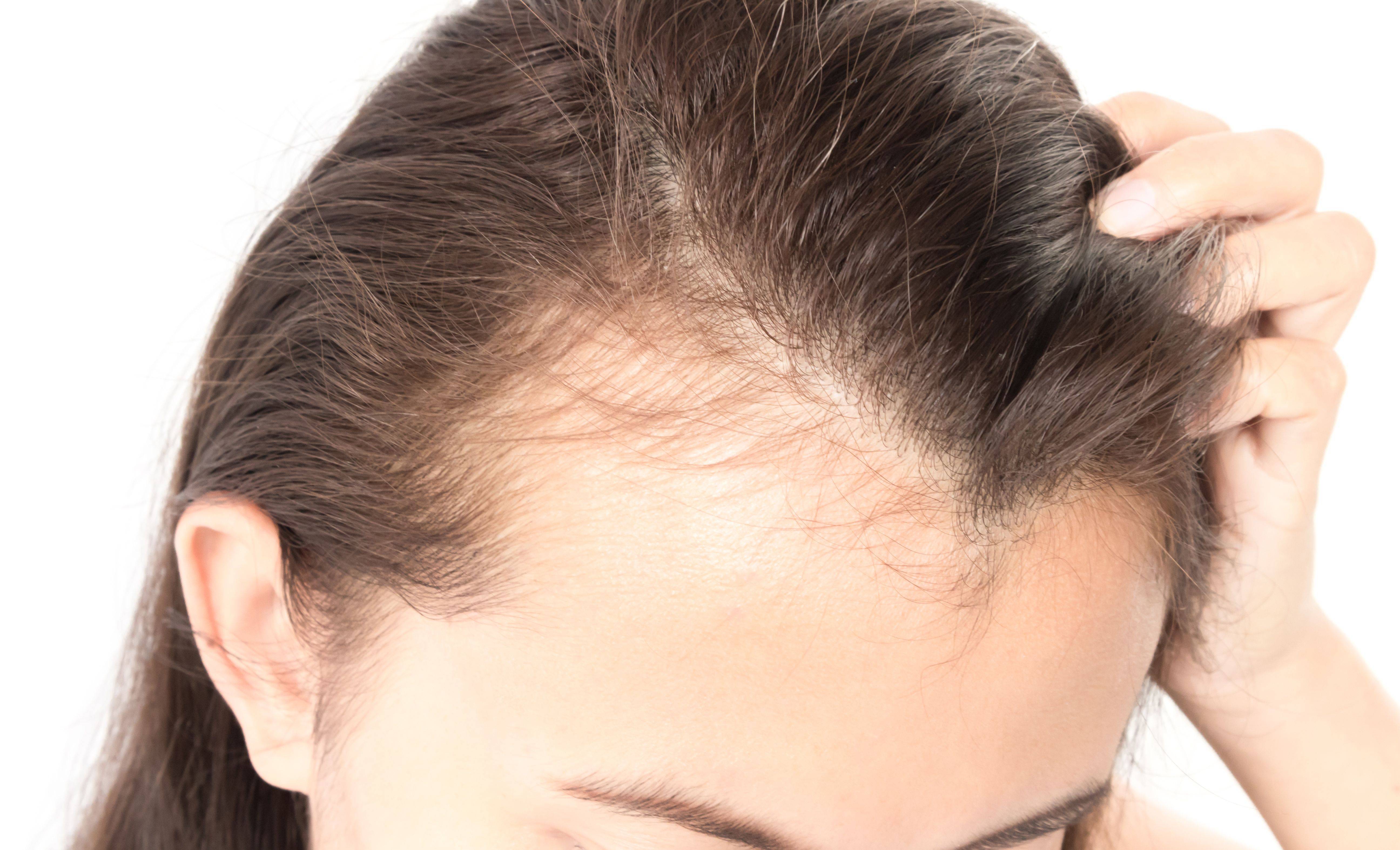 Лечение и причины ломкости волос у детей
