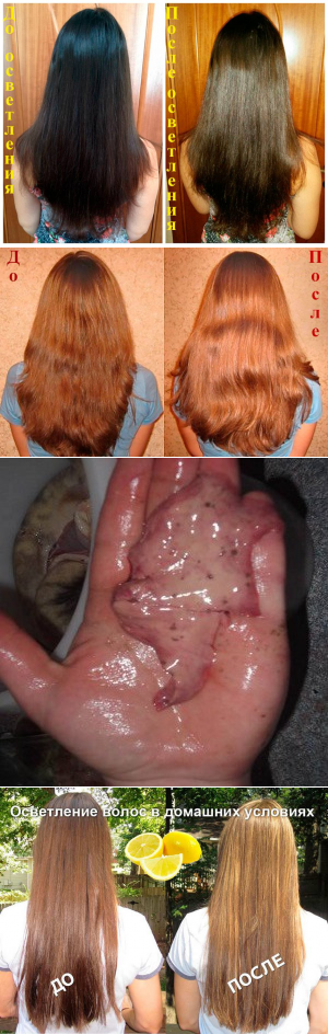 Осветление волос перекисью водорода: пошаговая инструкция, фото до и после