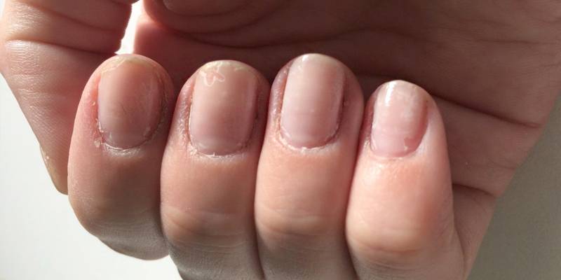 Как быстро восстановить ногти после наращивания