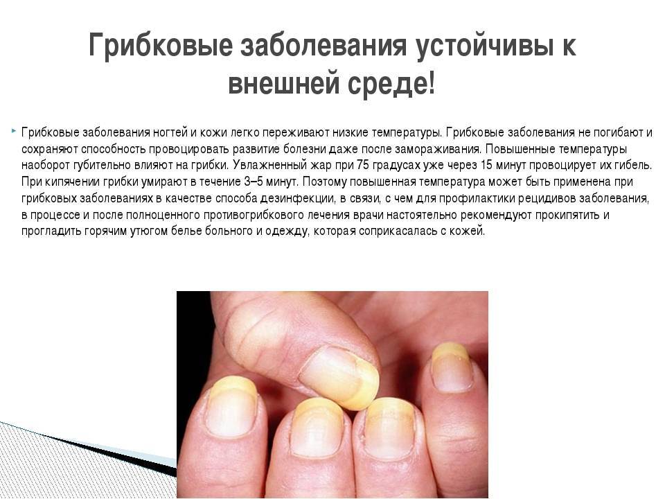 Полинейропатия