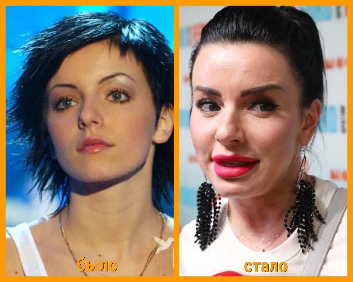 Юлия волкова до и после пластических операции, фото и видео » womanmirror