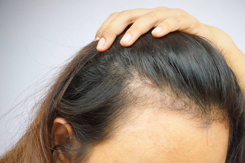 Лечение и причины ломкости волос у детей