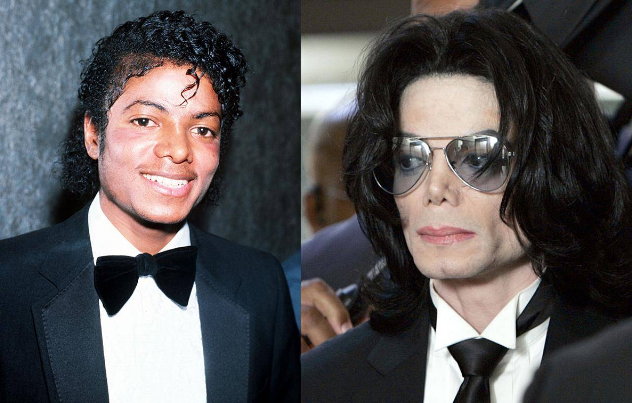 Майкл джексон до операций фото до и после