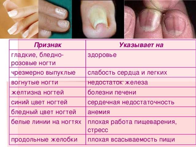 Что такое лунки на ногтях? большие лунки на ногтях пальцев рук и маленькие: значение для здоровья