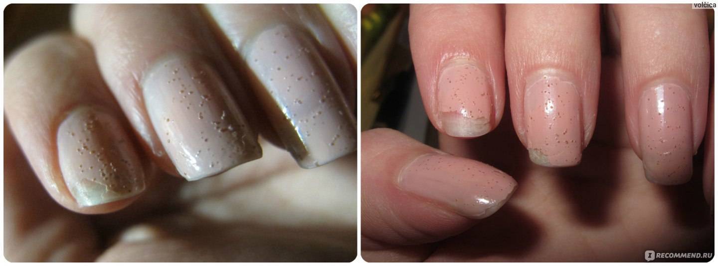 Причины пузырения лака на ногтях