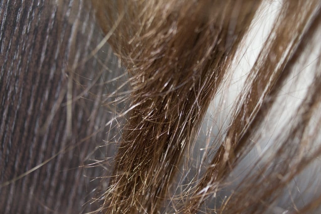 Ломкие волосы - лечение: 5 причин и лучшие средства от ломкости