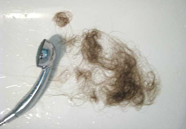Естественный процесс или отклонение от нормы: сколько волосков должно выпадать в день?