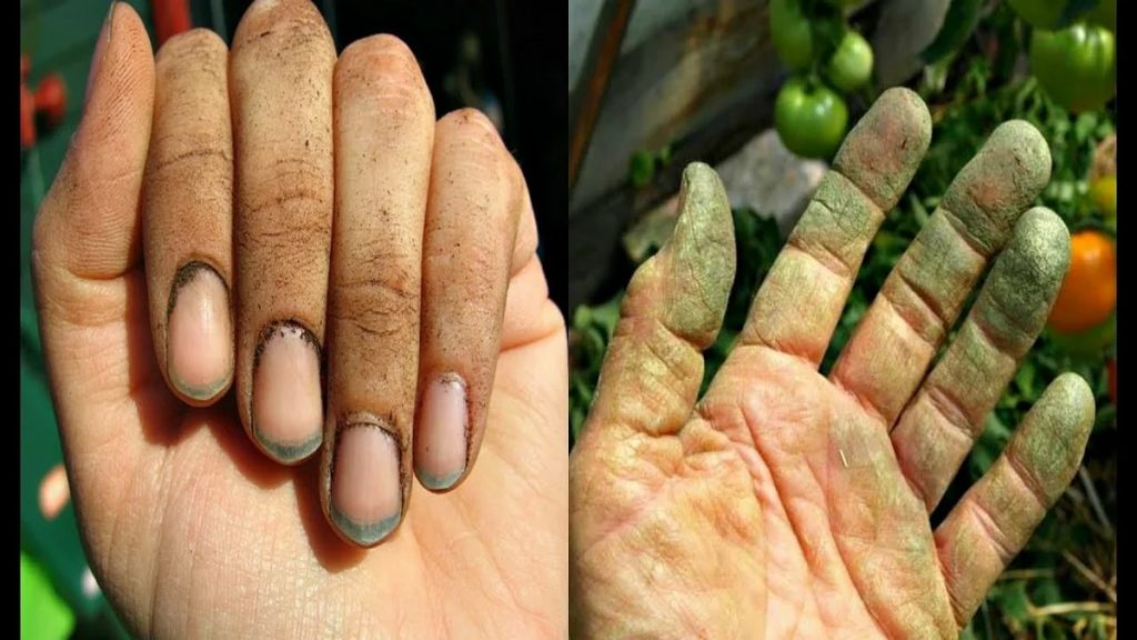 Чем можно удалить грязь из-под ногтей