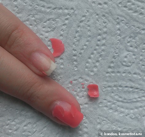 Как восстановить ногти после шеллака и гель-лака: лечение, укрепление, профилактика в домашних условиях