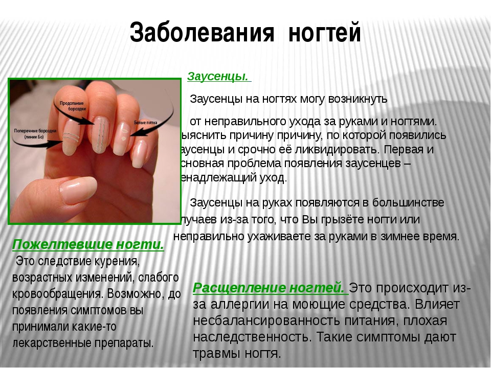 Что значат большие лунки на ногтях. лунки на ногтях — что они означают для здоровья человека