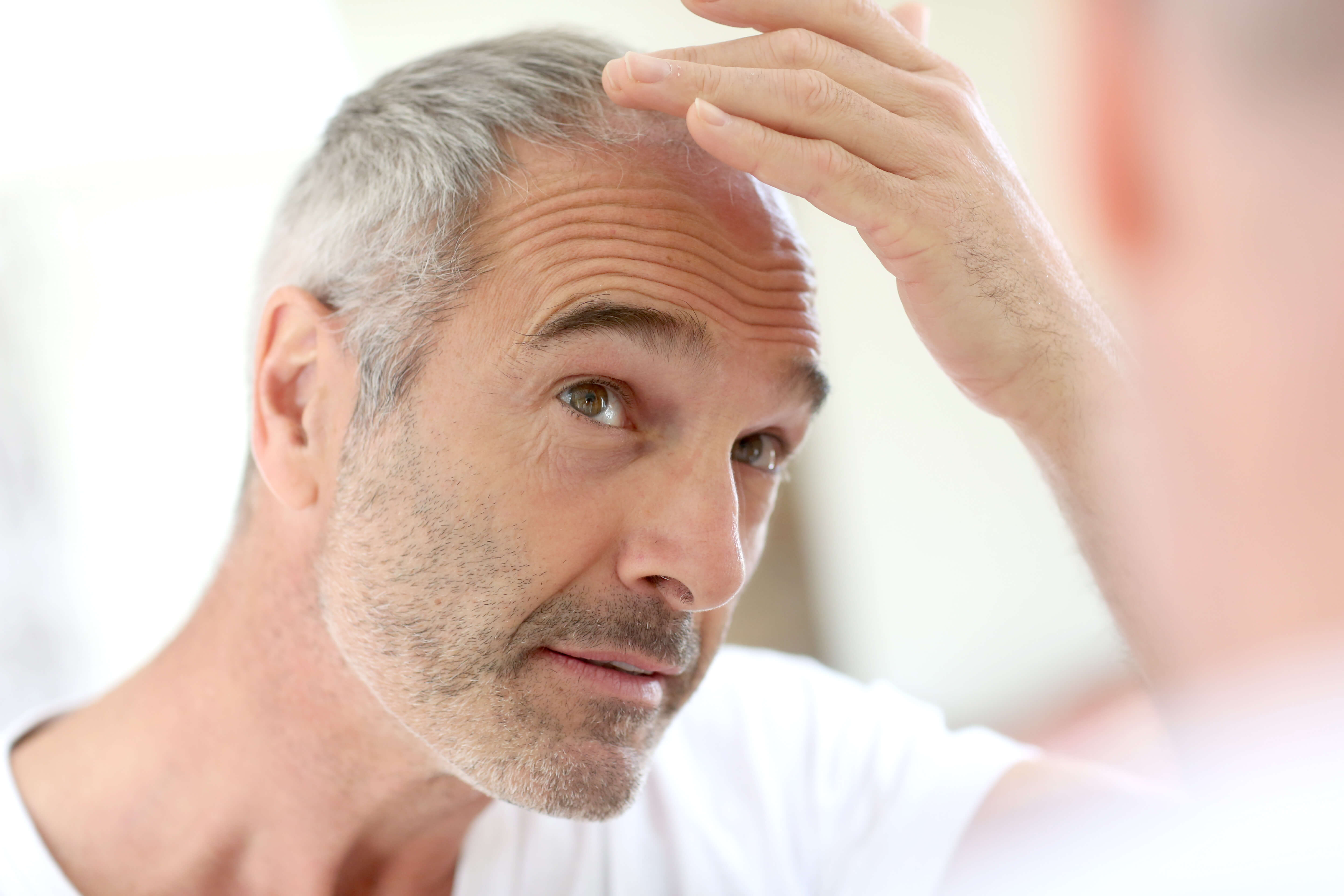 15 причин выпадения волос у мужчин - клиника «доктор волос»