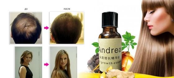 Средство для роста волос andrea: отзывы, как использовать и отличить оригинал | volosomanjaki.com