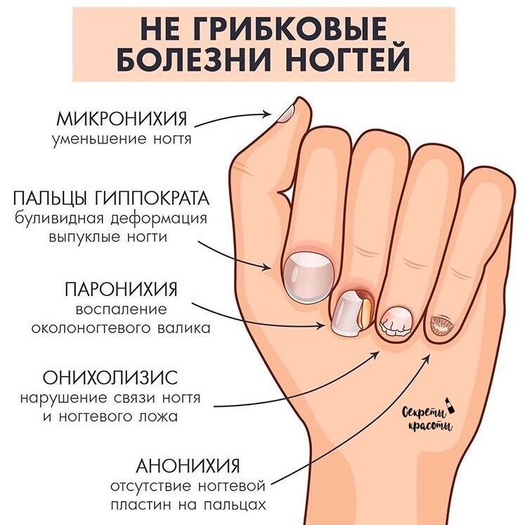 Лечение ногтей спб. лечение болезней ногтей в nail clinic