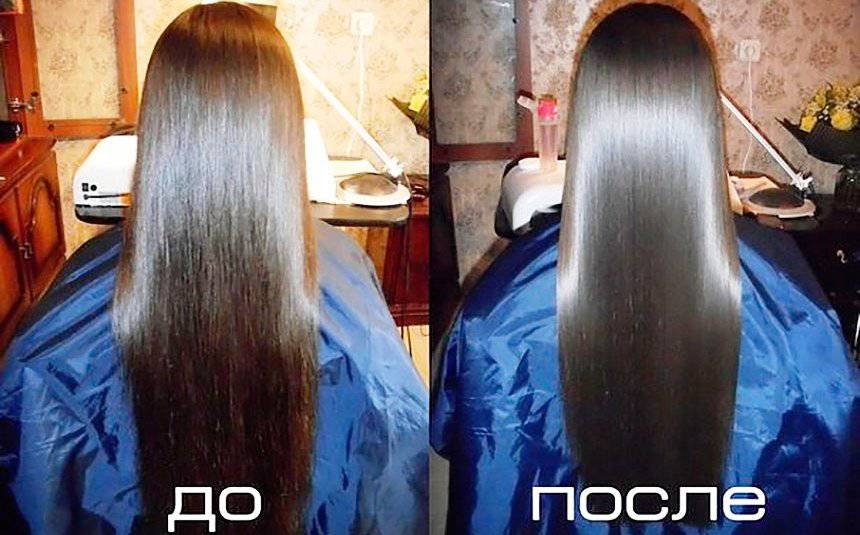 Восстановление волос после коронавируса