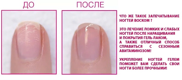 Запечатывание ногтей: что это такое и как проводится процедура?