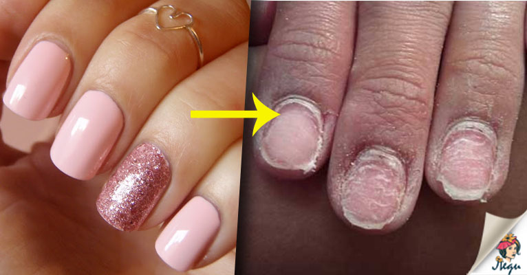 Очевидные и редкие причины, почему трескается гель-лак на ногтях