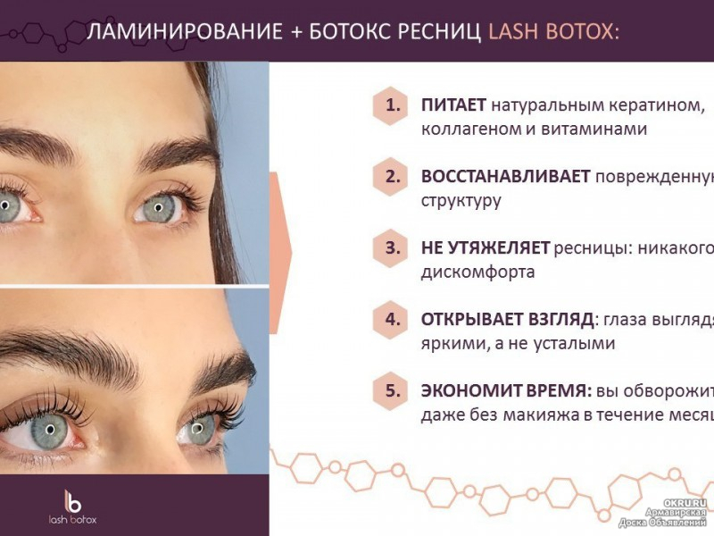Ботокс ресниц- суть и преимущества процедуры botox lashes
