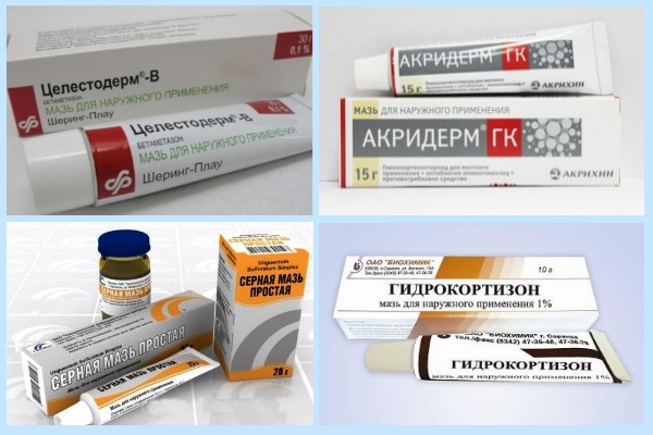 Лечение себорейного дерматита недорогими, но эффективными препаратами