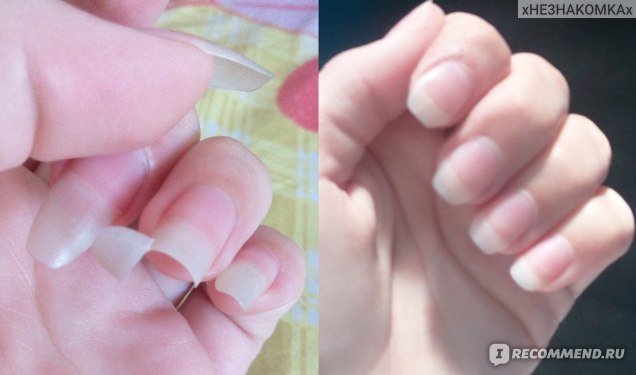 Как быстро отрастить свои ногти: как быстро отрастить ногти, используя домашние методы