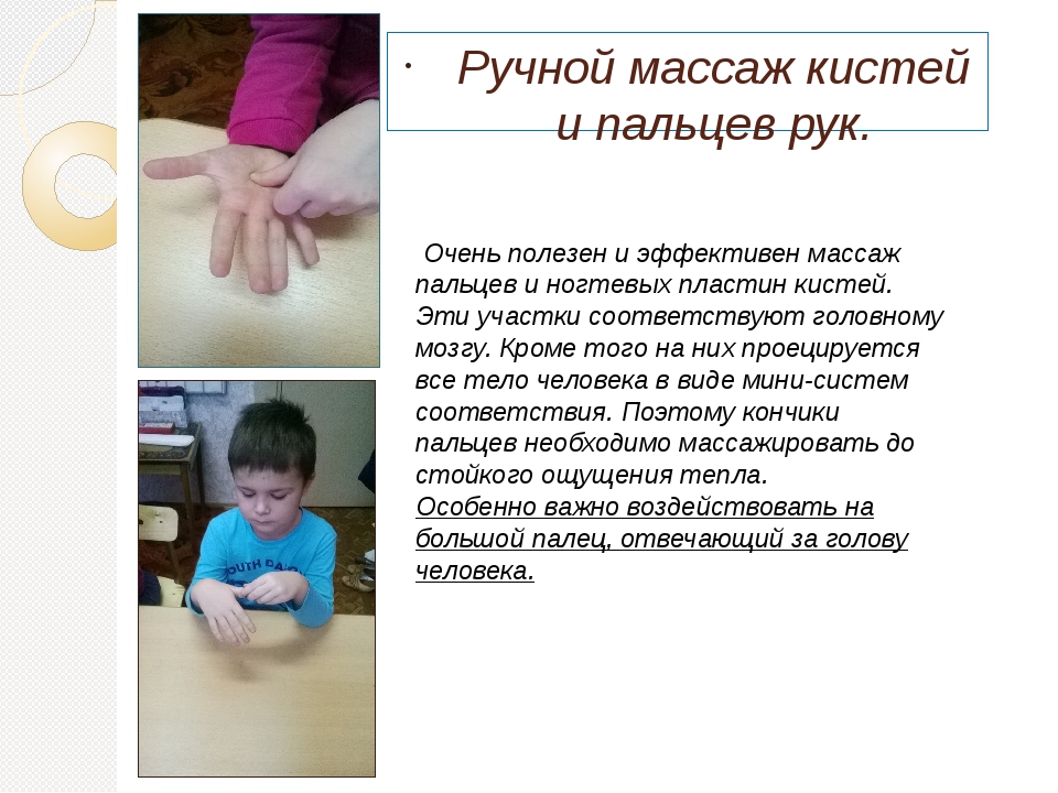Артроз кистей рук