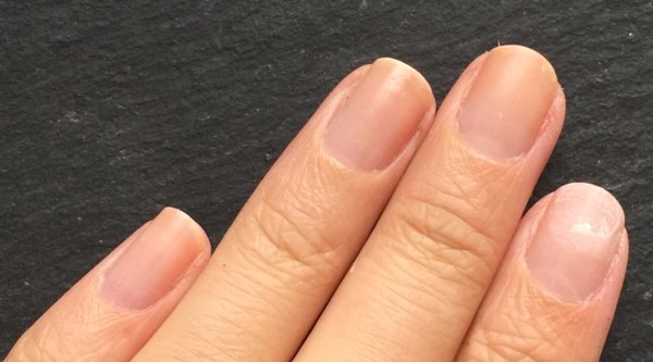 Почему ногти волнистые: главные причины и действенное лечение -фото — модный дизайн ногтей