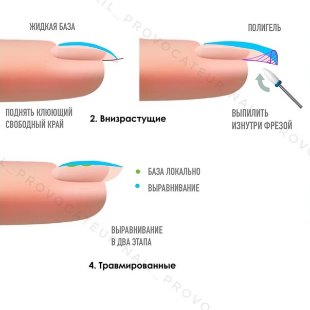 Ремонт ногтя гелем - подробно описание процедуры