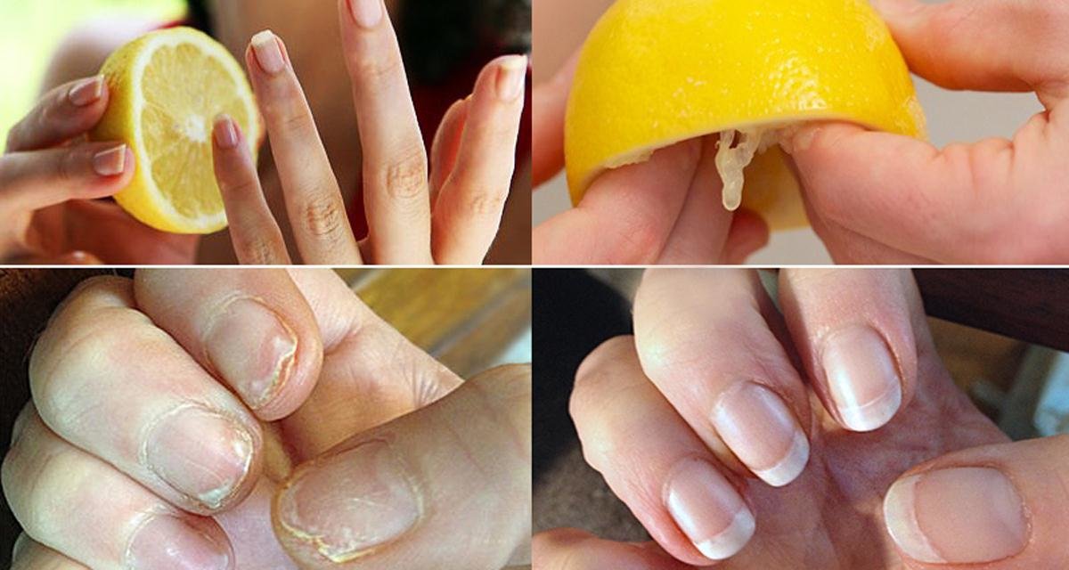 Как отрастить ногти за неделю в домашних условиях
