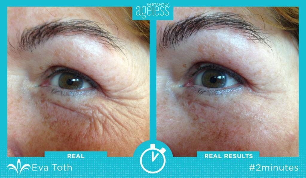 Крем instantly ageless от морщин: вся правда о препарате