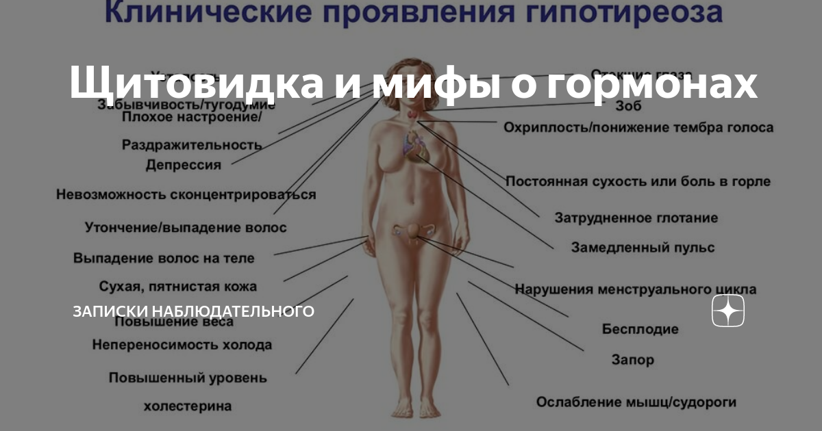 Могут ли быть проблемы. Щитовидная железа симптомы заболевания у женщин гипотиреоз. Клинические проявления при гипотиреозе и гипертиреозе. Гипотиреоз щитовидной железы симптомы. Сбой гормонов у женщин симптомы.