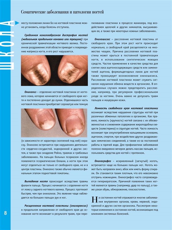 По какой причине ногти слоятся: способы лечения и простые профилактические меры