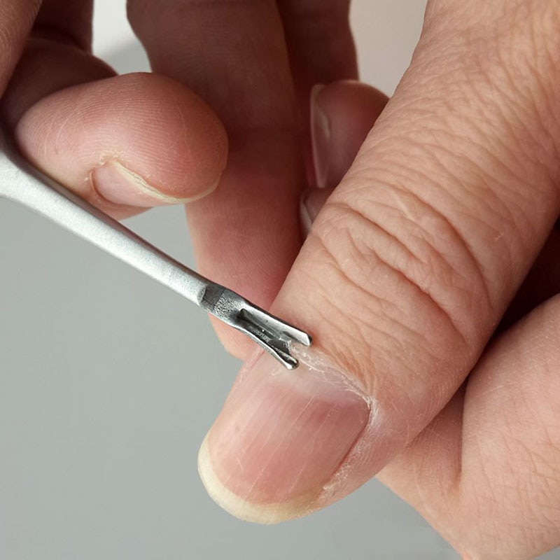 Заусенцы на пальцах: как избавиться от проблемы навсегда + меры профилактики -фото — модный дизайн ногтей